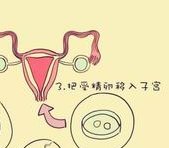 国内哪里做试管比较好的医院——试管医院前5排名已公布