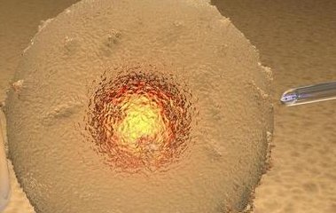 一个人做三代试管一般要多少费用？