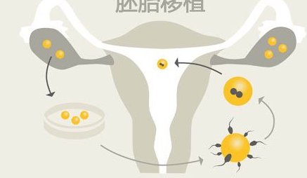 死精率80%的男性可以在凭祥市做三代试管吗？公开2026做三代试管条件