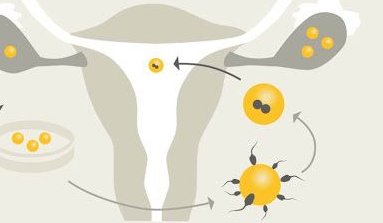 做泰国试管婴儿男性应该提前做好哪些准备？